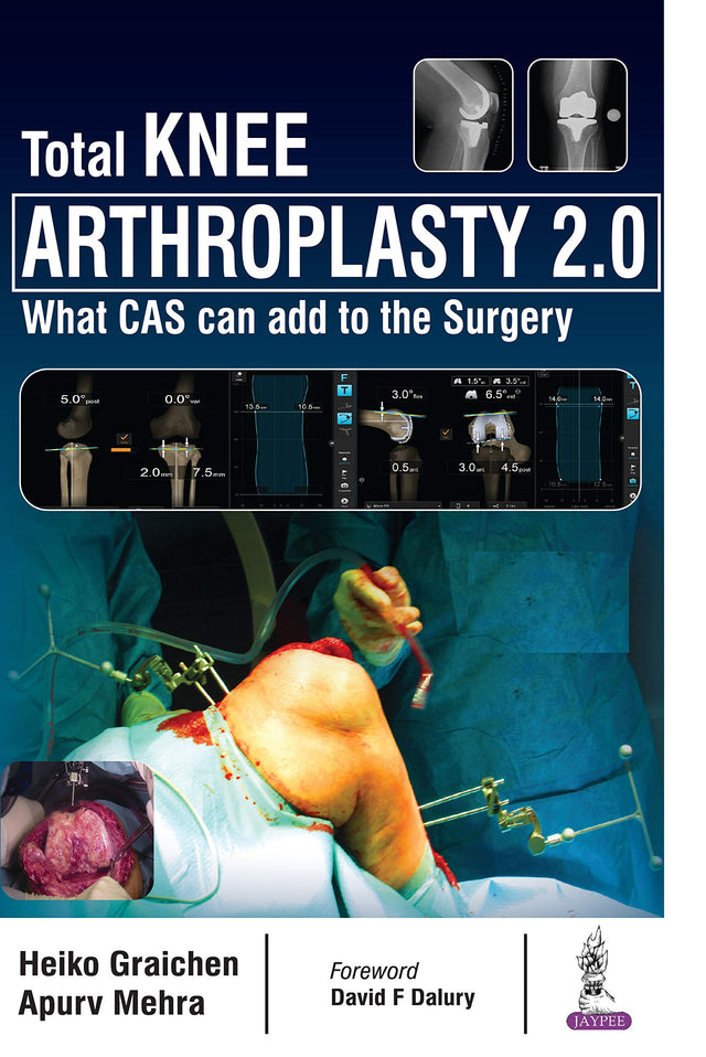 Total Knee Arthroplasty 2.0 - Retail Maharaj