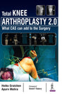 Total Knee Arthroplasty 2.0 - Retail Maharaj