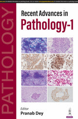 RECENT ADVANCES IN PATHOLOGY-1 - Retail Maharaj