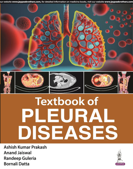 Textbook of Pleural Diseases - Retail Maharaj