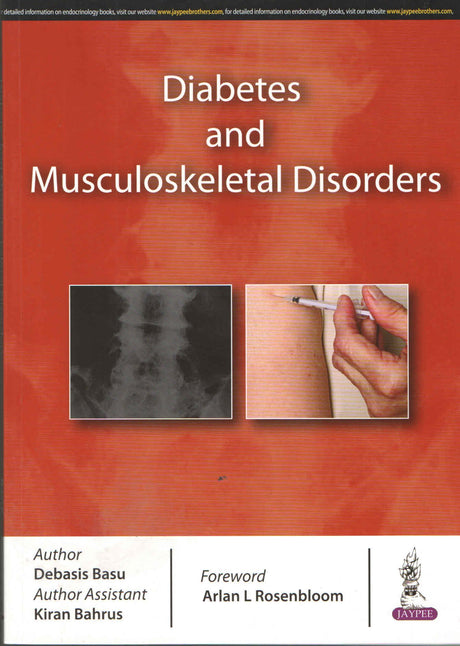Diabetes and Musculoskeletal Disorders - Retail Maharaj