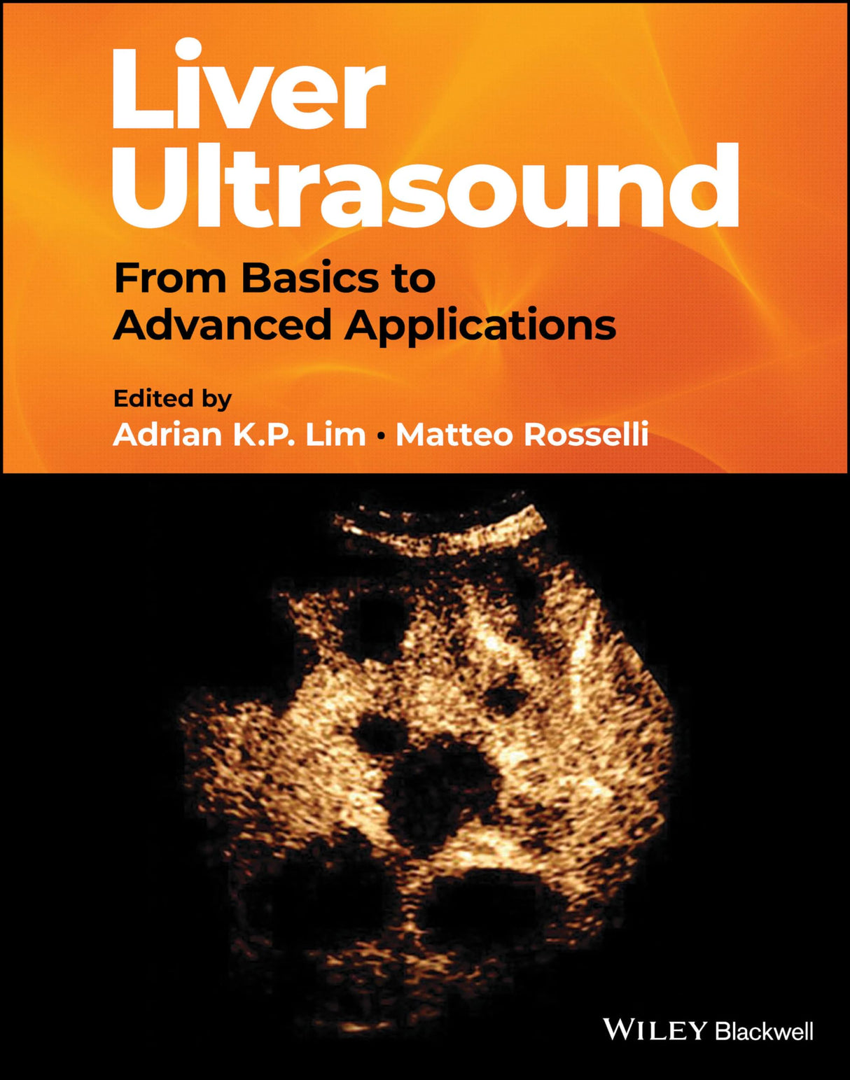 Liver Ultrasound: From Basics to Advanced Applicat ions - Retail Maharaj