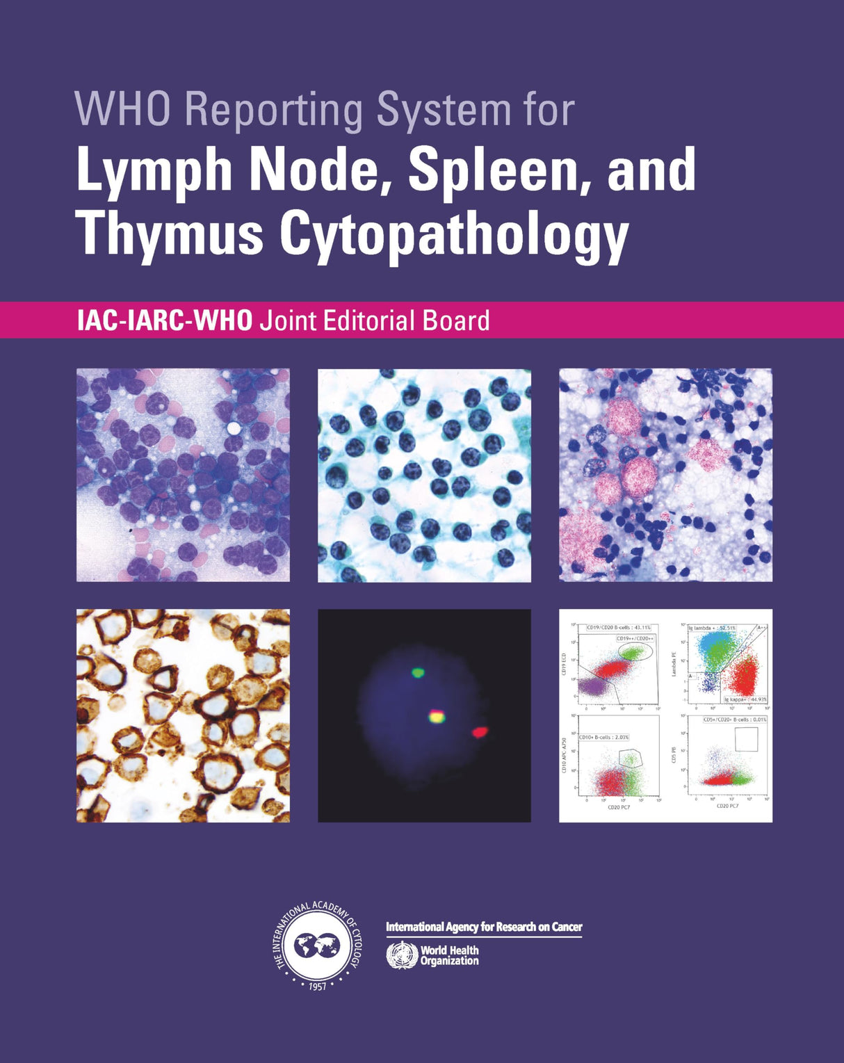 Who Reporting System for Lymph Node, Spleen, and Thymus Cytopathology - Retail Maharaj