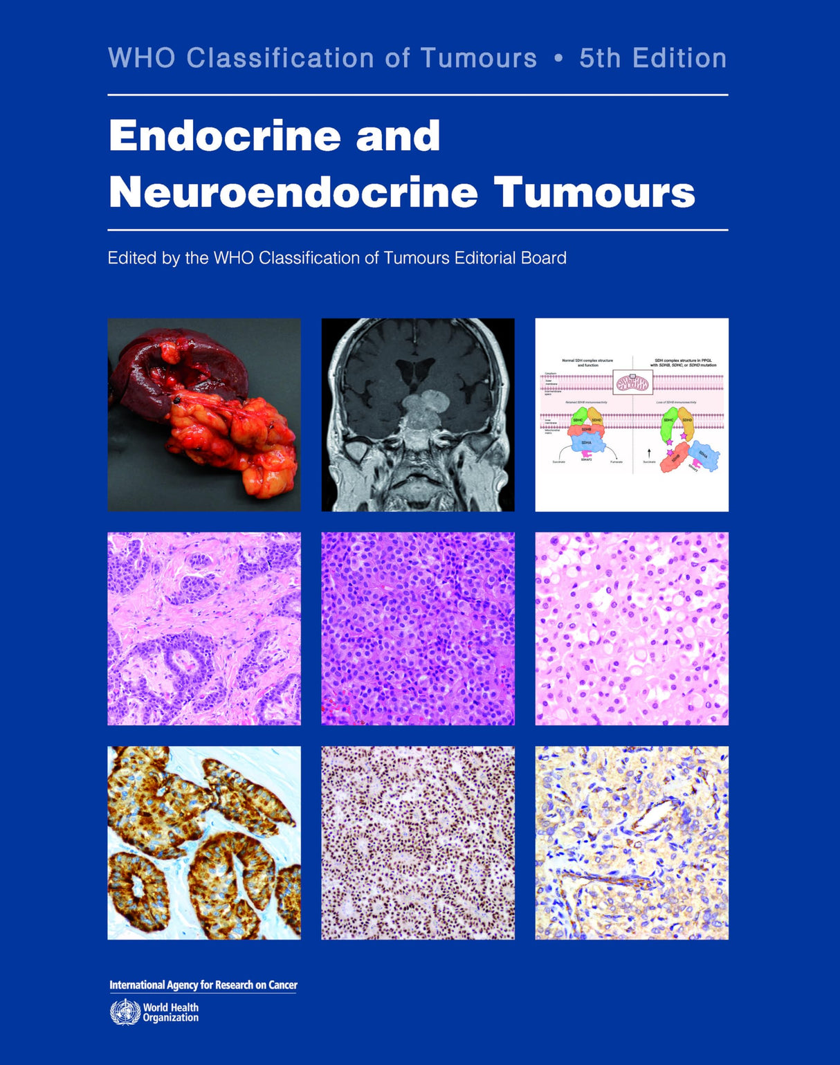 Endocrine and Neuroendocrine Tumours - Retail Maharaj