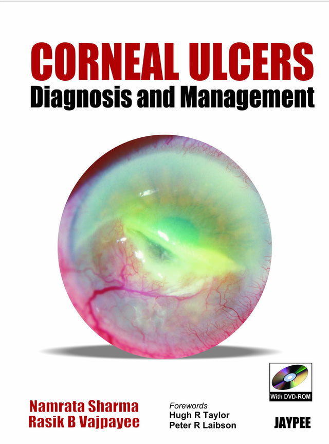 Corneal Ulcer Diagnosis and Management with DVD-ROM - Retail Maharaj