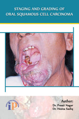 Staging and Grading of Oral Squamous Cell Carcinoma - Retail Maharaj