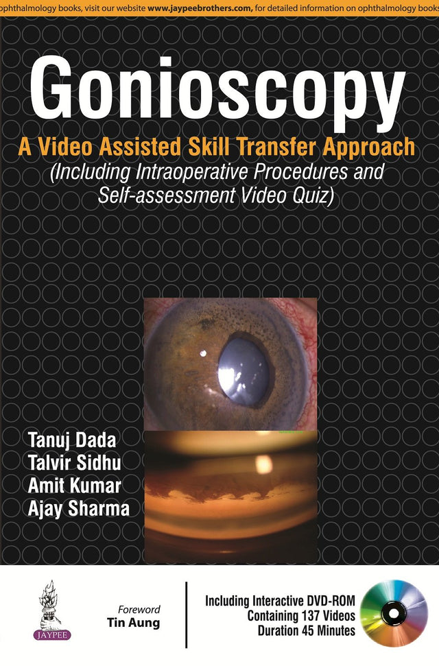 GONIOSCOPY:A VIDEO ASSISTED SKILL TRANSFER APPROACH WITH DVD-ROM - Retail Maharaj