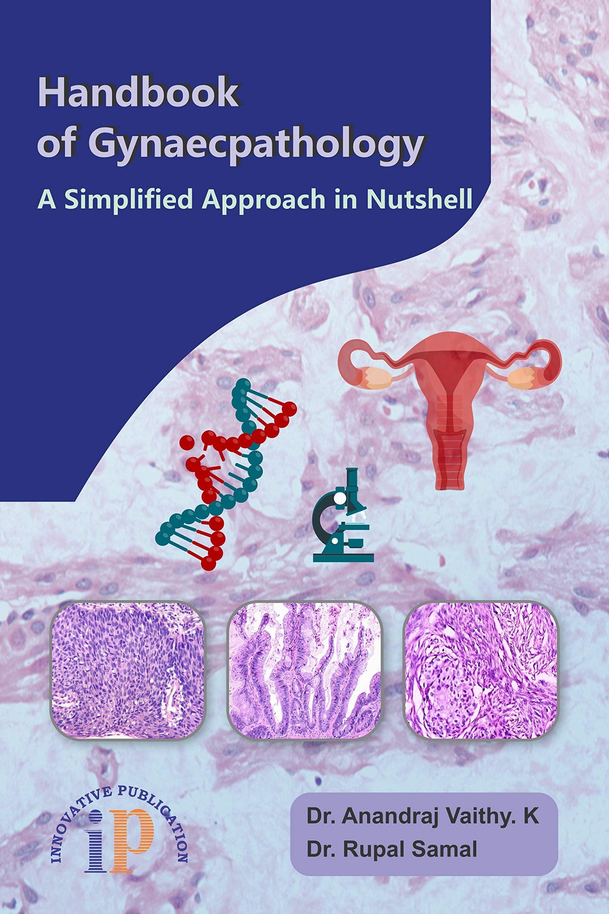 Handbook of Gynaecpathology – A Simplified Approach in Nutshell (First Edition, 2020) - Retail Maharaj