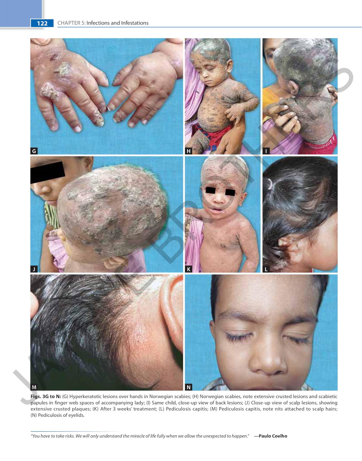 COLOR ATLAS & SYNOPSIS OF PEDIATRIC DERMATOLOGY - Retail Maharaj