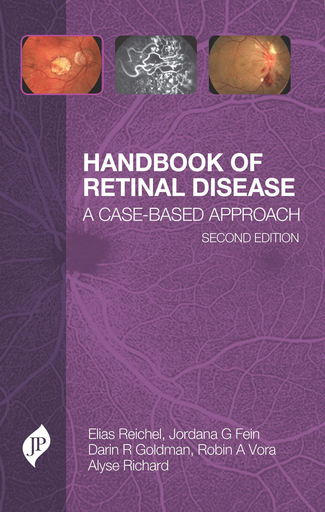 Handbook of Retinal Disease: A Case- Based Approach: A Cased-Based Approach - Retail Maharaj
