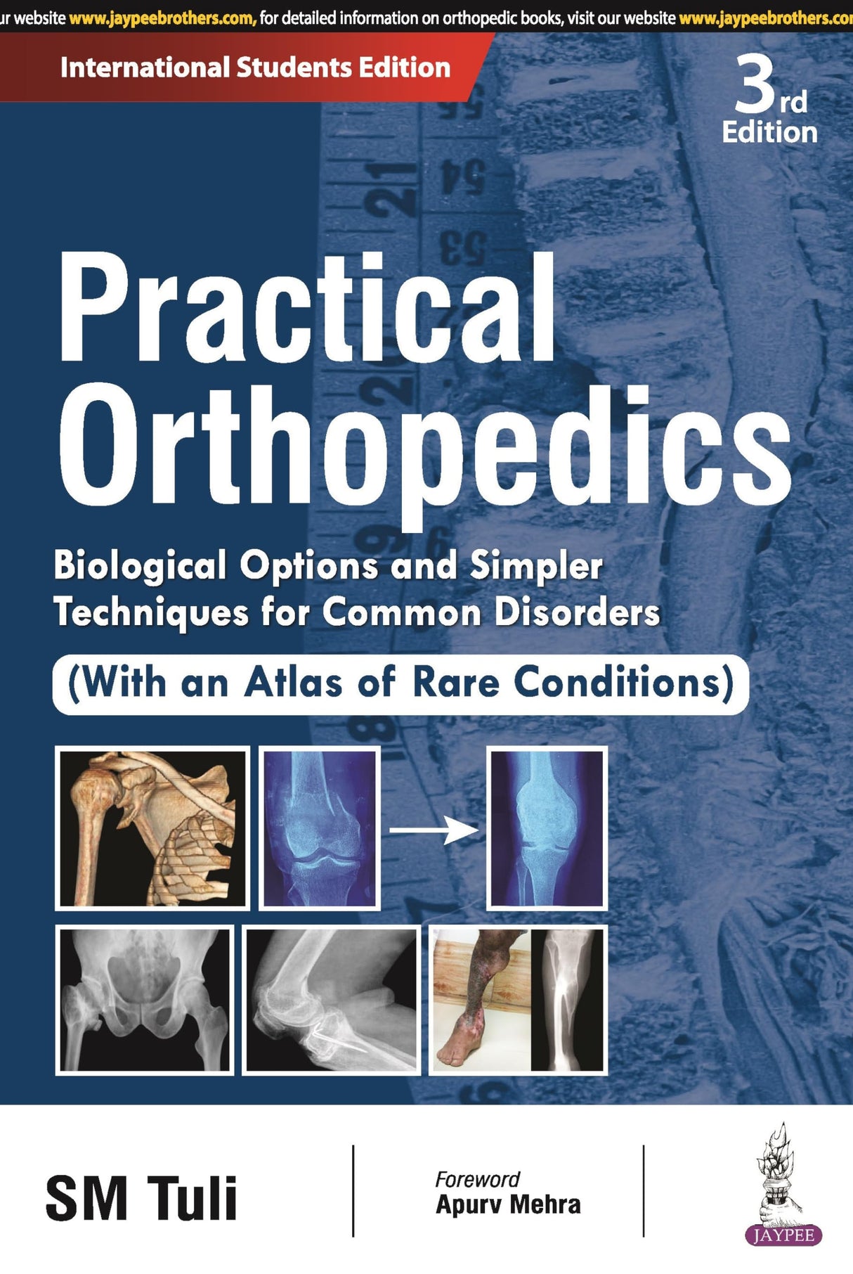 PRACTICAL ORTHOPEDICS: BIOLOGICAL OPTIONS AND SIMPLER TECHNIQUES FOR COMMON DISORDERS (WITH AN ATLAS - Retail Maharaj