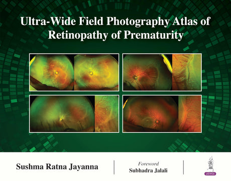 Ultra-Wide Field Photography Atlas of Retinopathy of Prematurity - Retail Maharaj