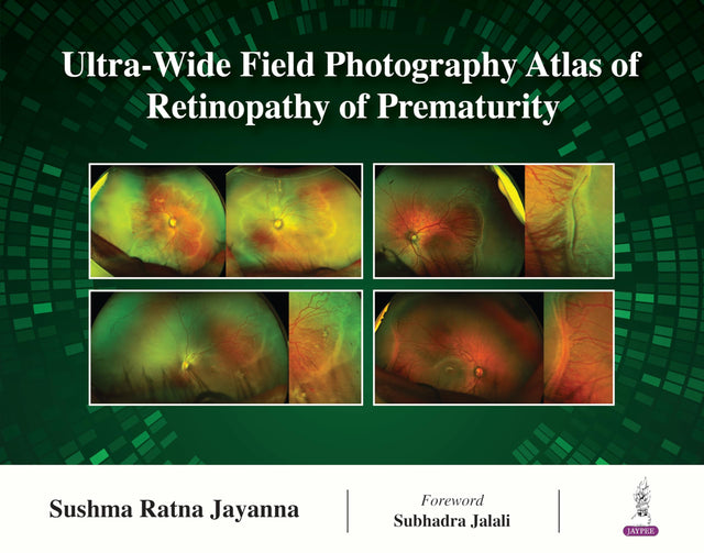 Ultra-Wide Field Photography Atlas of Retinopathy of Prematurity - Retail Maharaj