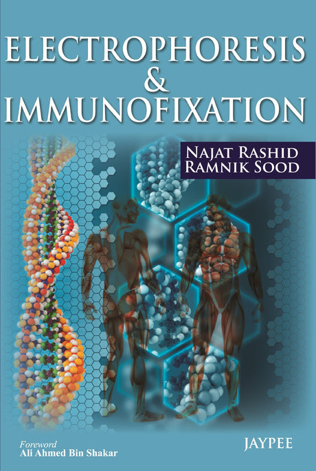 Electrophoresis & Immunofixation - Retail Maharaj