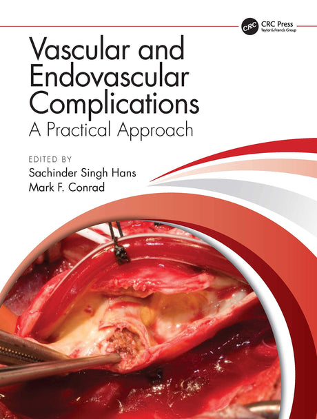 Vascular and Endovascular Complications: A Practical Approach - Retail Maharaj