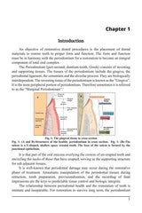 Gingival Tissue Management: Emphasis on Operative and Prosthodontic Aspect, Dec 2019, Operative Dentistry Books - Retail Maharaj