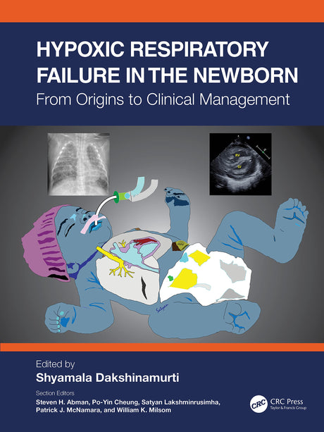 Hypoxic Respiratory Failure in the Newborn: From Origins to Clinical Management - Retail Maharaj