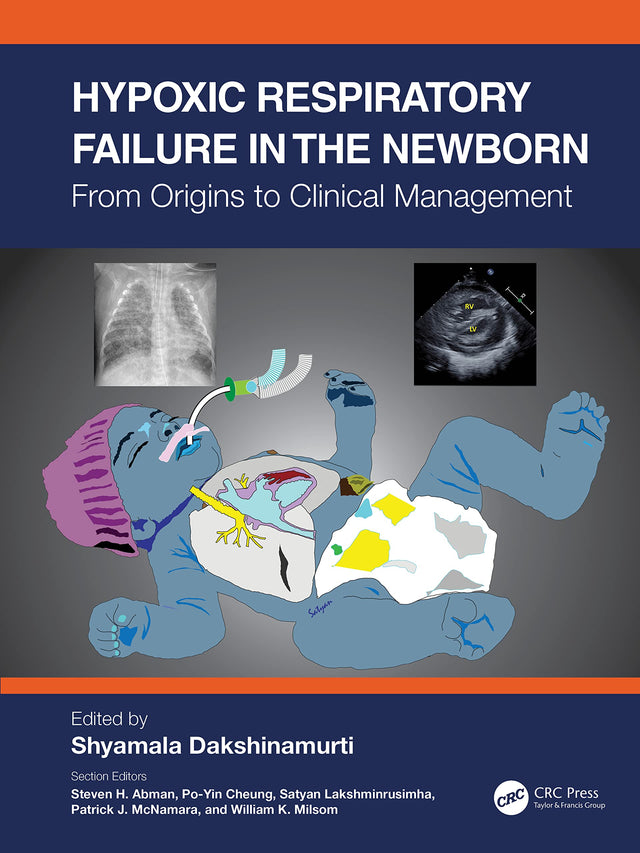 Hypoxic Respiratory Failure in the Newborn: From Origins to Clinical Management - Retail Maharaj