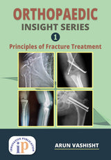 Orthopaedic Insight Series 1 : Principles of Fracture Treatment - Retail Maharaj