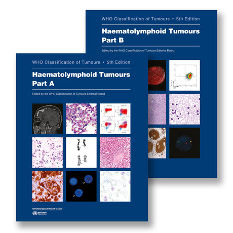Haematolymphoid Tumours: Who Classification of Tumours - Retail Maharaj