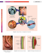 Illustrated Textbook of ENT and Head & Neck Surgery (1st Edition 2025) - Retail Maharaj