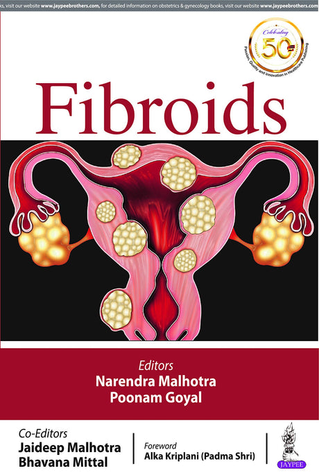 FIBROIDS - Retail Maharaj