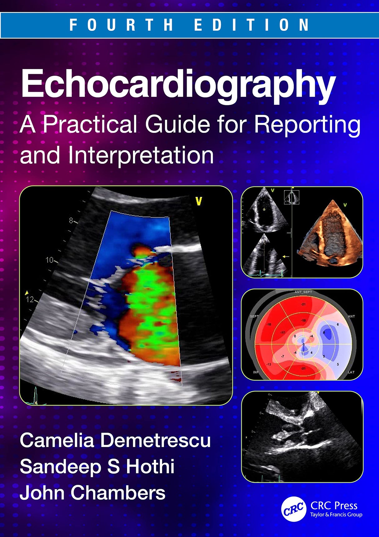 ECHOCARDIOGRAPHY A PRACTICAL GUIDE FOR REPORTING AND INTERPRETATION 4ED (PB 2024) - Retail Maharaj