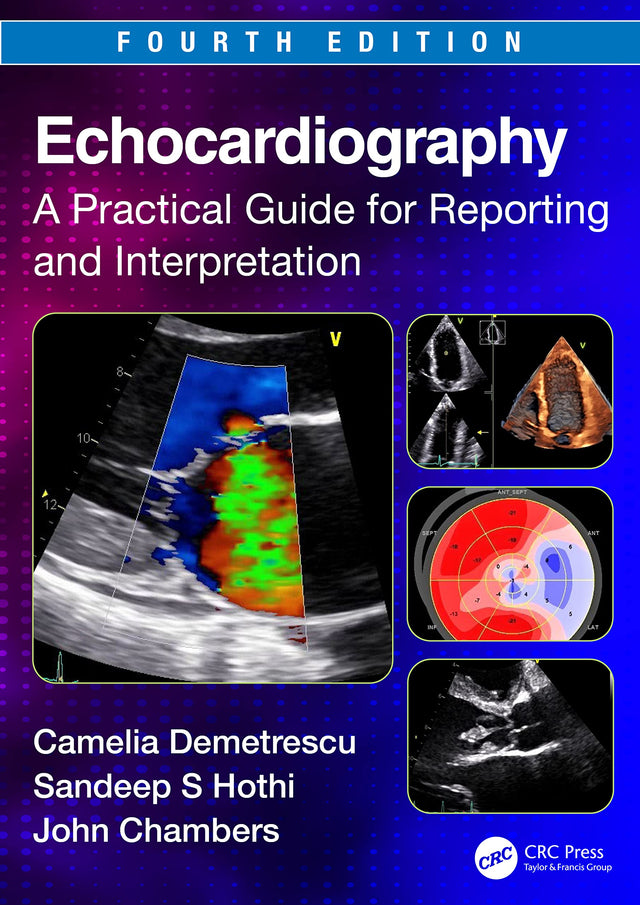 ECHOCARDIOGRAPHY A PRACTICAL GUIDE FOR REPORTING AND INTERPRETATION 4ED (PB 2024) - Retail Maharaj