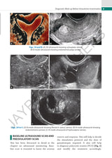PRACTICAL GUIDE TO INTRAUTERINE INSEMINATION (IUI) - Retail Maharaj