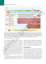 PREGNANCY & KIDNEY DISEASES - Retail Maharaj
