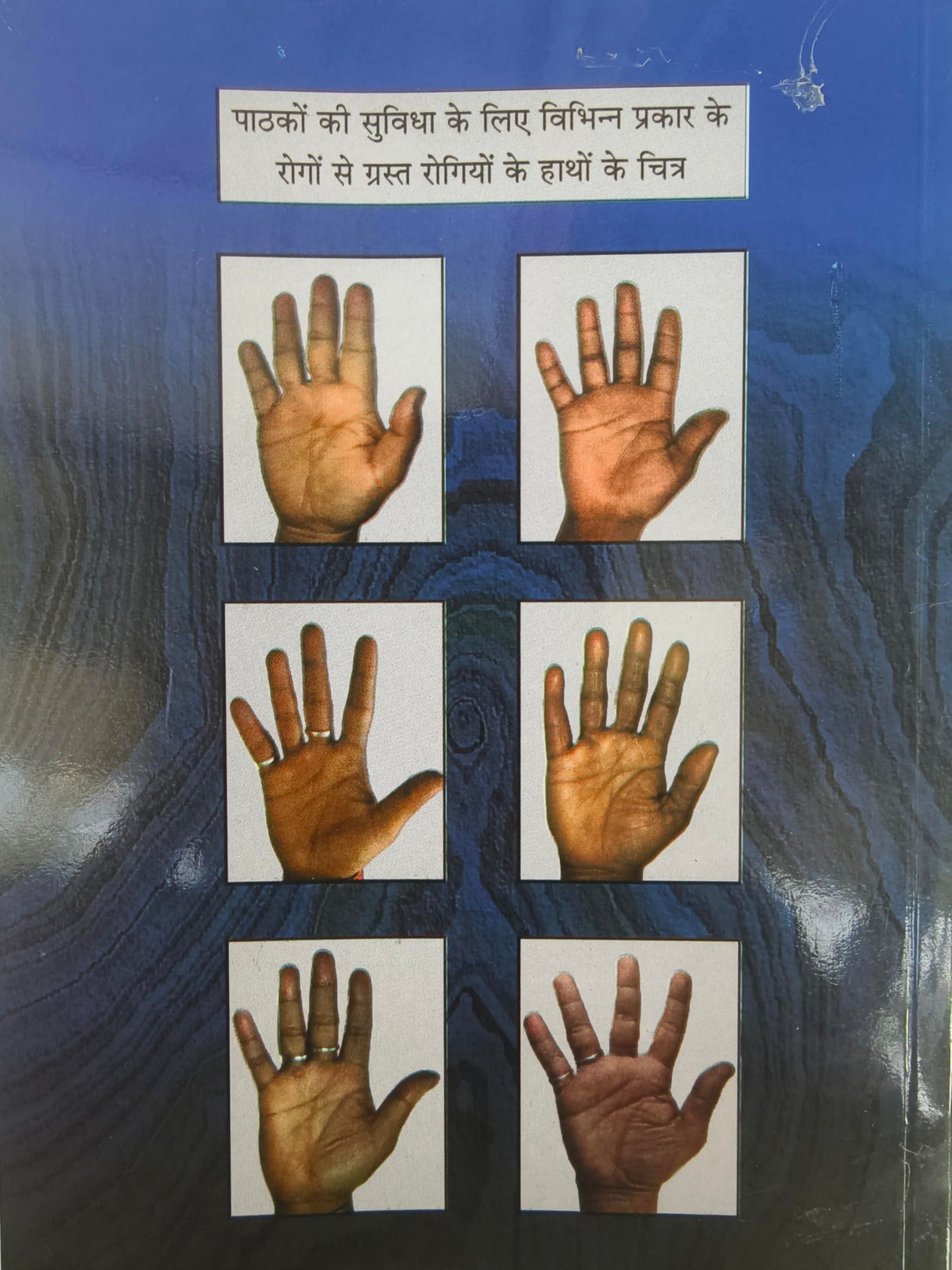 Medical Palmistry / हस्तरेखाओं से रोग की पहचान By Gopal Raju - Retail Maharaj