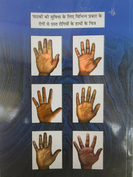 Medical Palmistry / हस्तरेखाओं से रोग की पहचान By Gopal Raju - Retail Maharaj