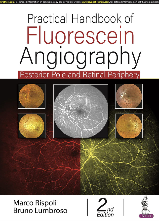 PRACTICAL HANDBOOK OF FLUORESCEIN ANGIOGRAPHY: POSTERIOR AND RETINAL PERIPHERY - Retail Maharaj