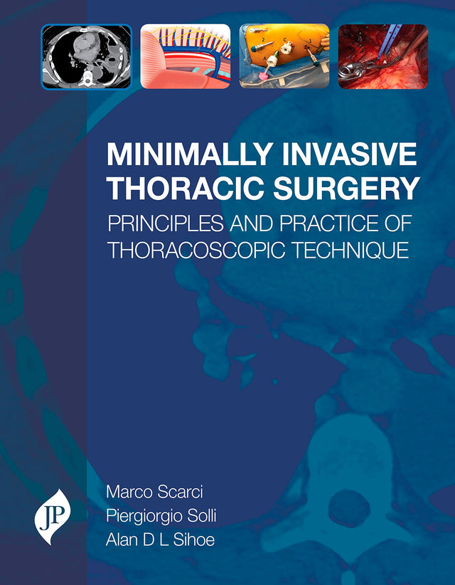 MINIMALLY INVASIVE THORACIC SURGERY PRINCIPLES AND PRACTICE OF THORACOSCOPIC TECHNIQUE - Retail Maharaj
