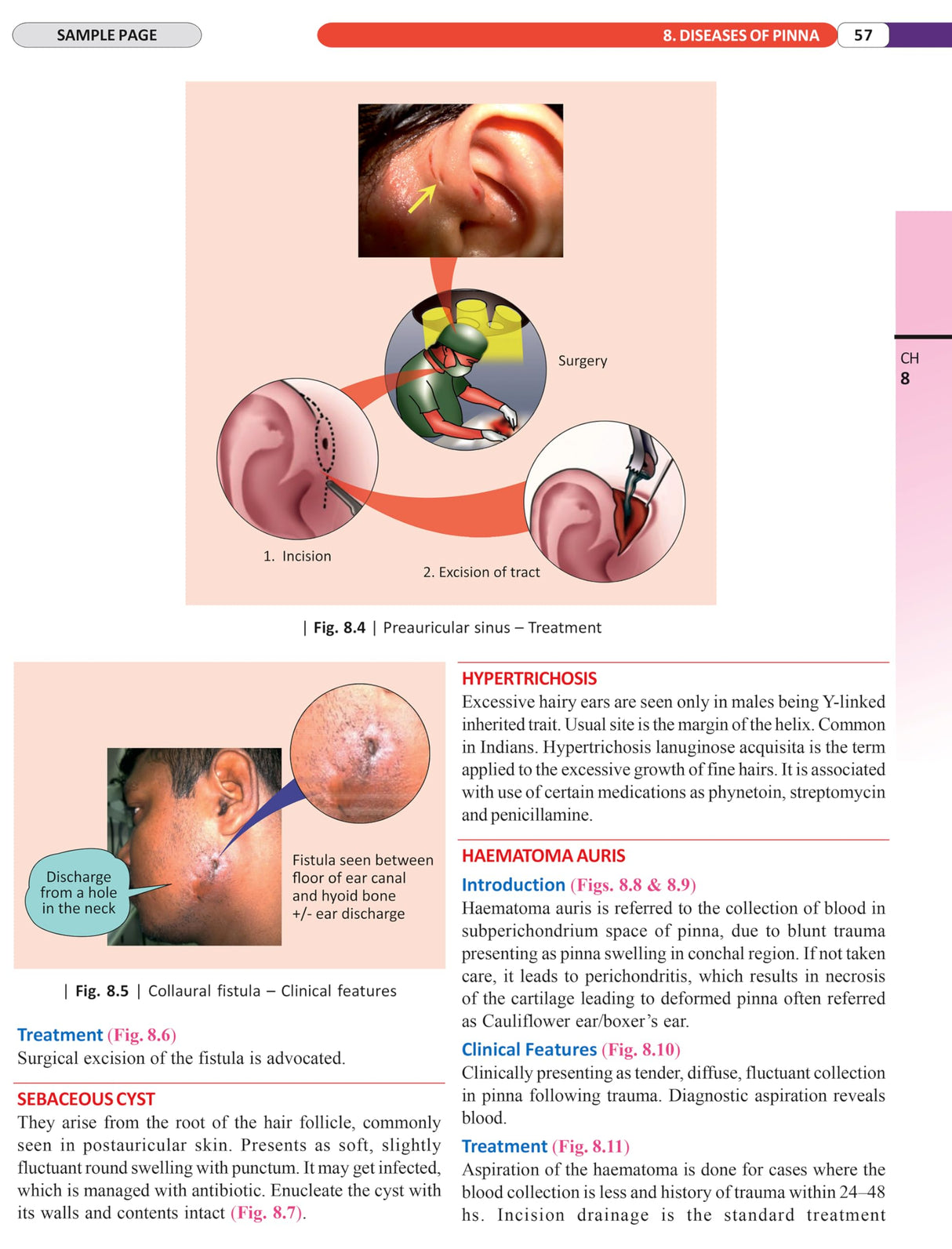 Illustrated Textbook of ENT and Head & Neck Surgery (1st Edition 2025) - Retail Maharaj