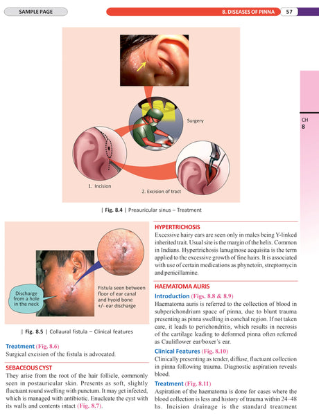 Illustrated Textbook of ENT and Head & Neck Surgery (1st Edition 2025) - Retail Maharaj