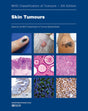 Skin Tumours: Who Classification of Tumours - Retail Maharaj