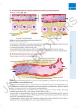 PATHOLOGY SIMPLIFIED: A QUICK REVIEW FOR EXAMINATION PREPARATION - Retail Maharaj