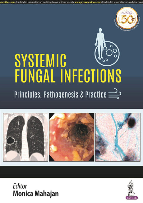 SYSTEMIC FUNGAL INFECTIONS: PRINCIPLES, PATHOGENESIS & PRACTICE - Retail Maharaj