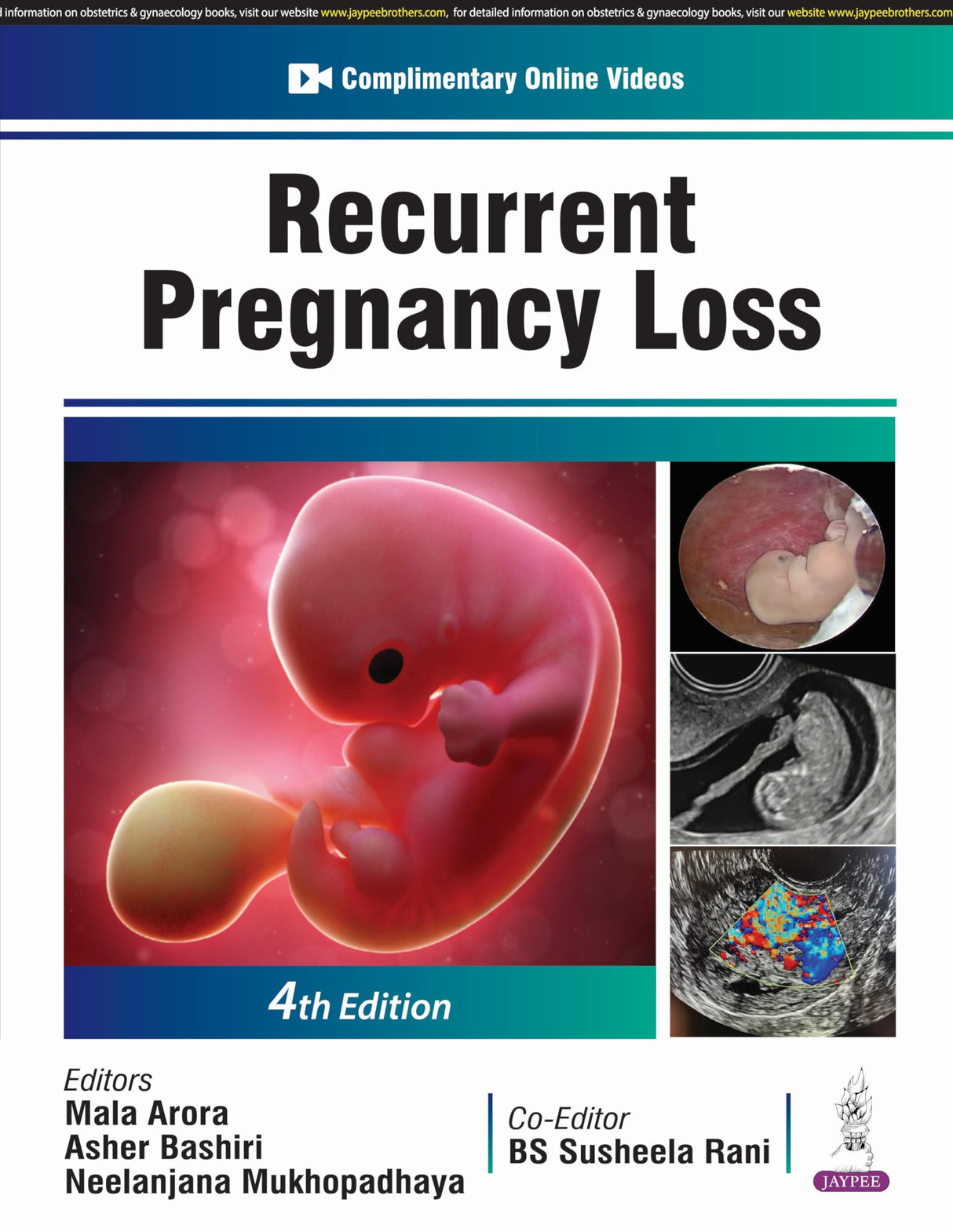 RECURRENT PREGNANCY LOSS - Retail Maharaj