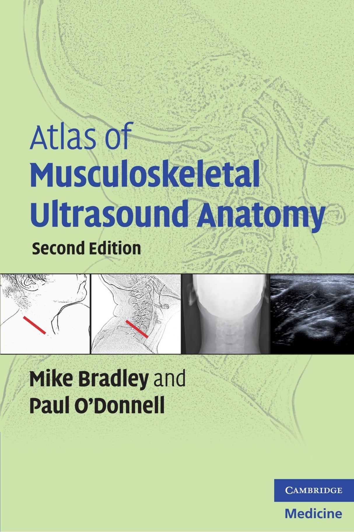 Atlas of Musculoskeletal Ultrasound Anatomy - Retail Maharaj