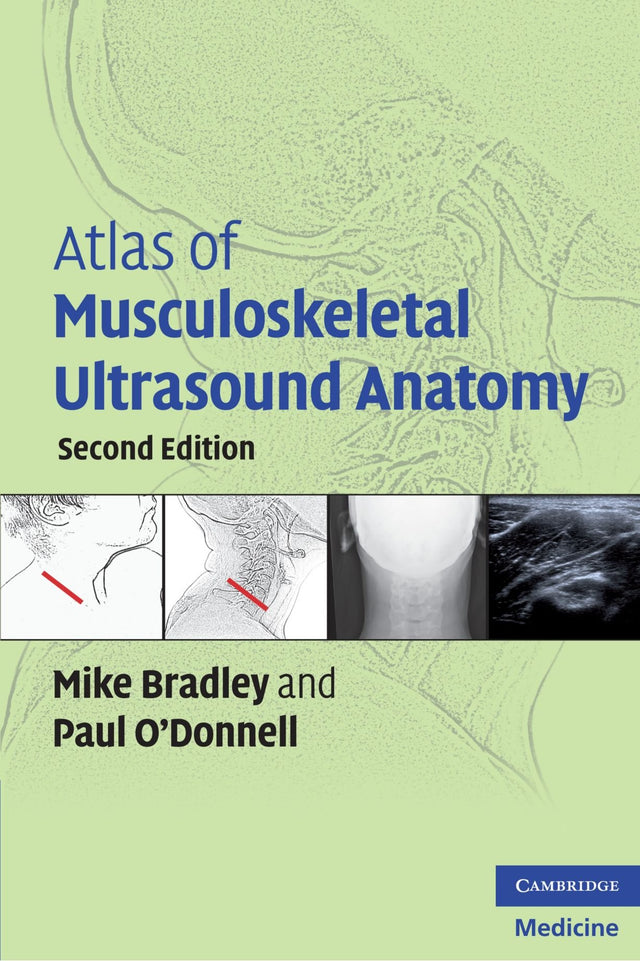 Atlas of Musculoskeletal Ultrasound Anatomy - Retail Maharaj