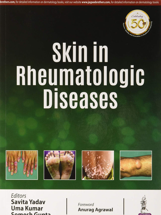 SKIN IN RHEUMATOLOGIC DISEASES - Retail Maharaj
