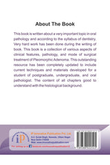 Pleomorphic Adenoma - Retail Maharaj