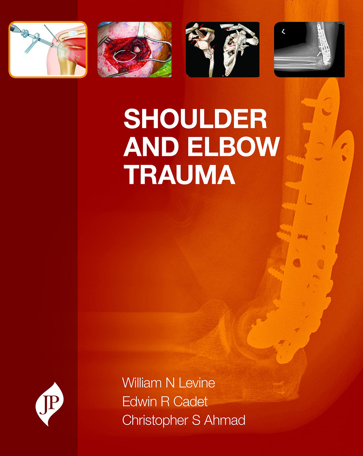 Shoulder and Elbow Trauma - Retail Maharaj