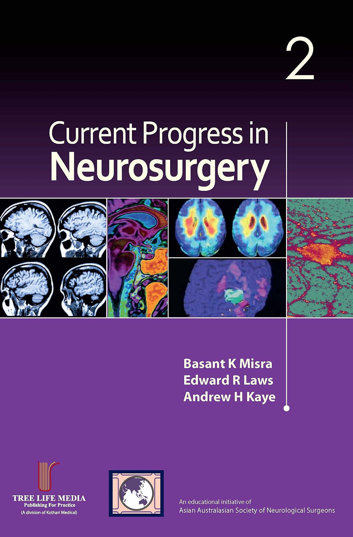 Current Progress in Neurosurgery Volume 2 (Current Progress) - Retail Maharaj