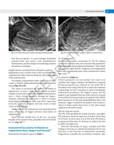 DECISION MAKING IN TRANSVAGINAL SONOGRAPHY - Retail Maharaj