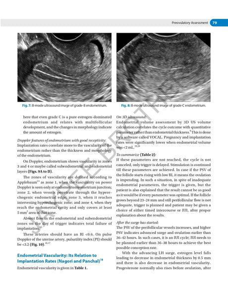 DECISION MAKING IN TRANSVAGINAL SONOGRAPHY - Retail Maharaj