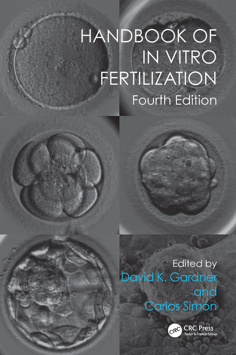 Handbook of In Vitro Fertilization - Retail Maharaj