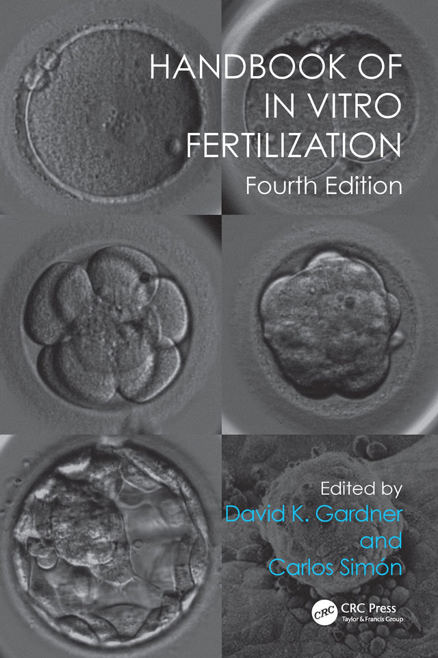 Handbook of In Vitro Fertilization - Retail Maharaj